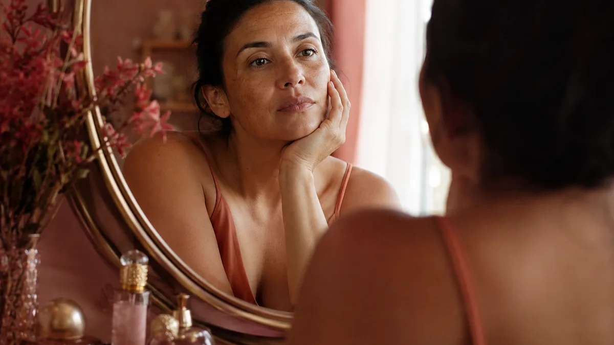 Melasma